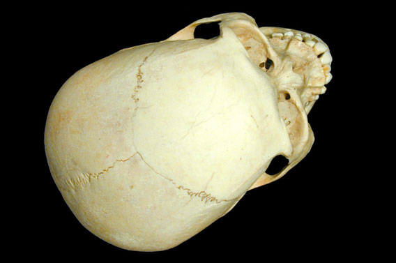 Menselijke schedel